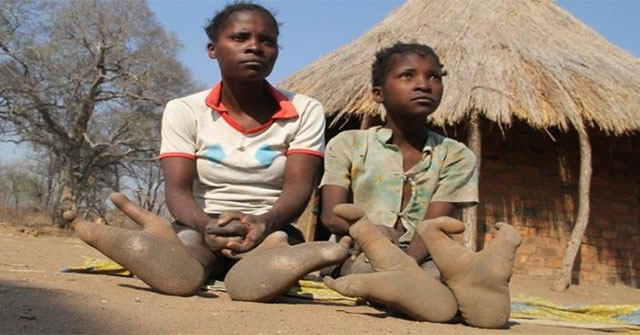 Khám Phá Bộ Lạc Vadoma: Những Đặc Điểm Kỳ Lạ Của Người Dân Chân Đà Điểu